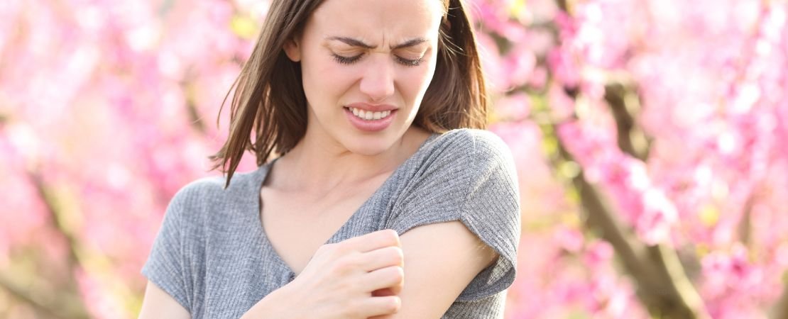 woman in tshirt scratching a bug bite